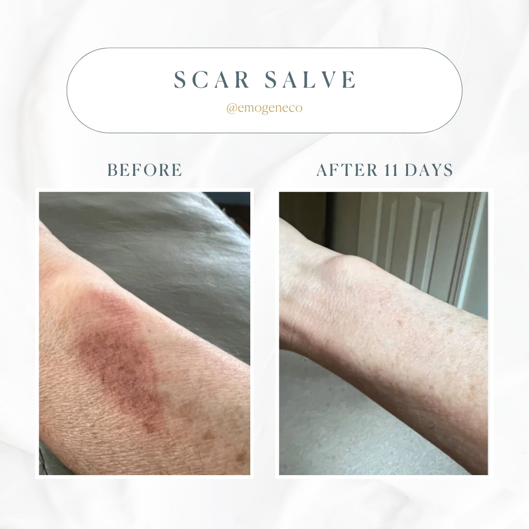 Emogene Signature Scar Salve