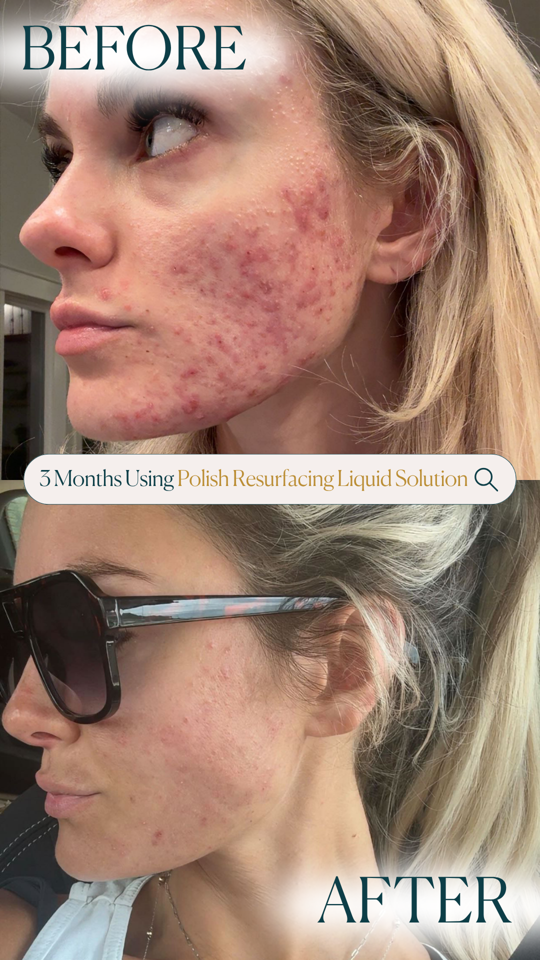 Polish Resurfacing Liquid Solution