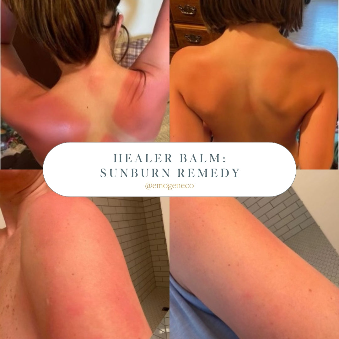 The Healer All Purpose Balm