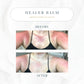 The Healer All Purpose Balm