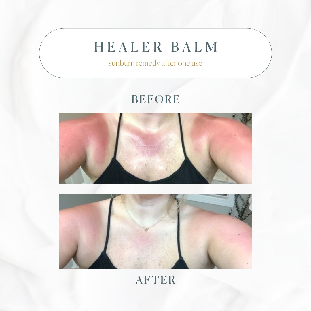 The Healer All Purpose Balm