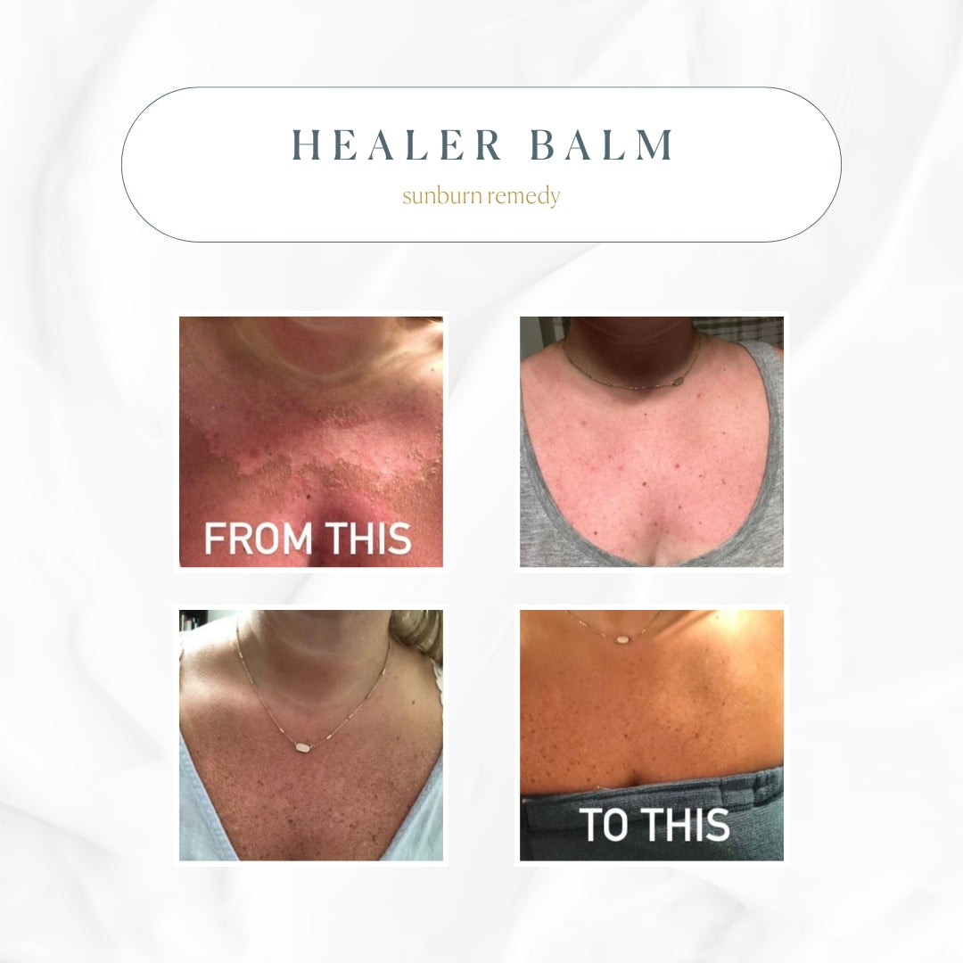 The Healer All Purpose Balm