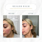 The Healer All Purpose Balm