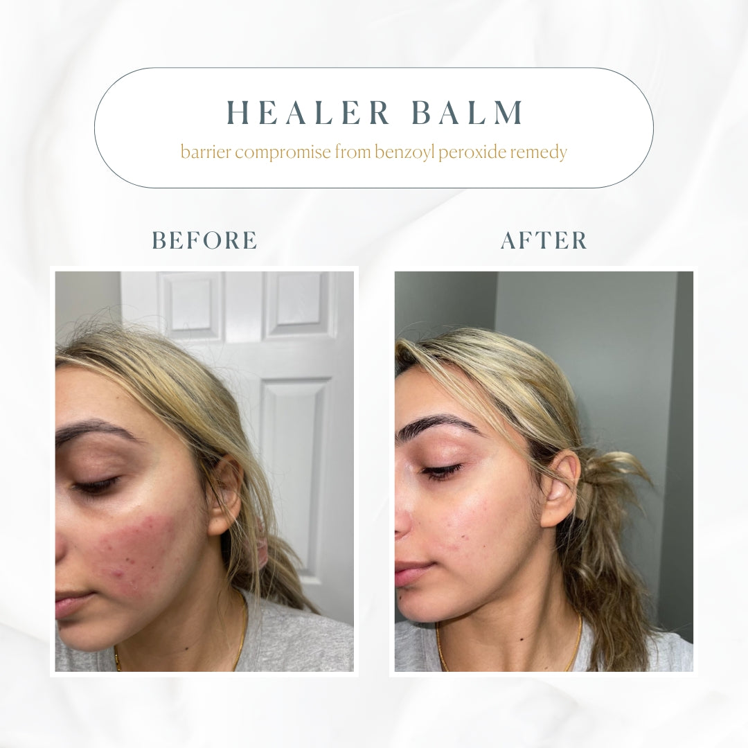The Healer All Purpose Balm