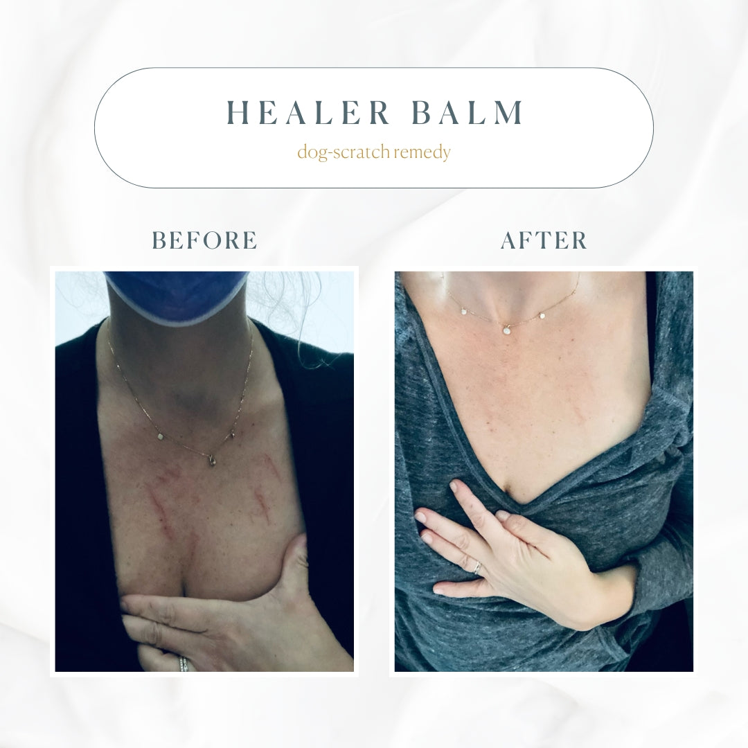 The Healer All Purpose Balm