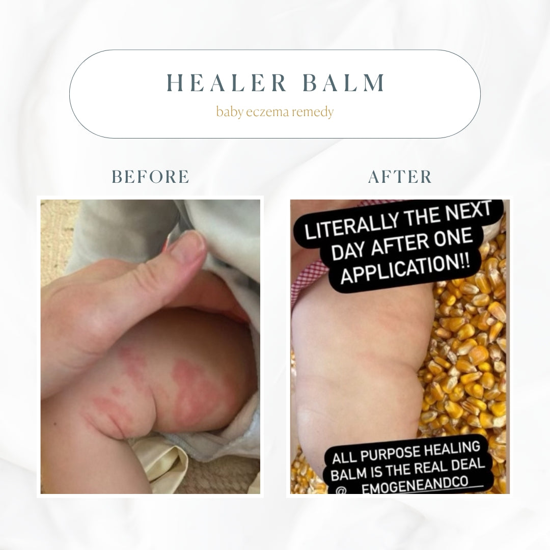 The Healer All Purpose Balm