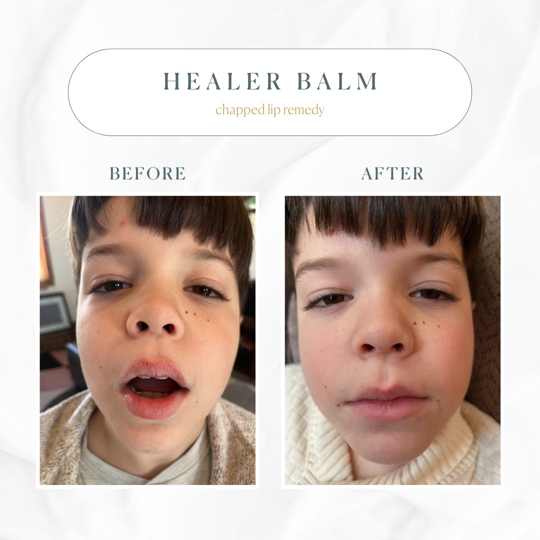 The Healer All Purpose Balm