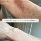 Emogene Signature Scar Salve
