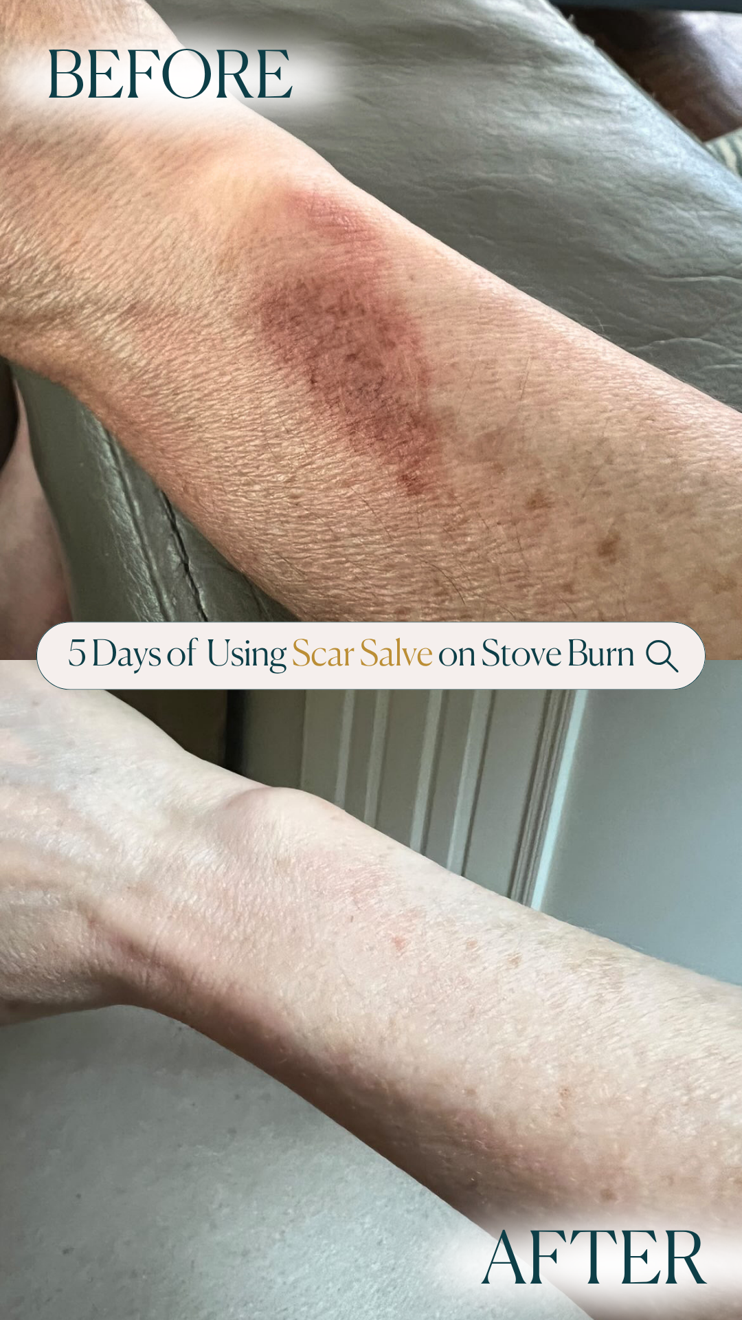 Emogene Signature Scar Salve