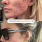 Repair Facial Oil