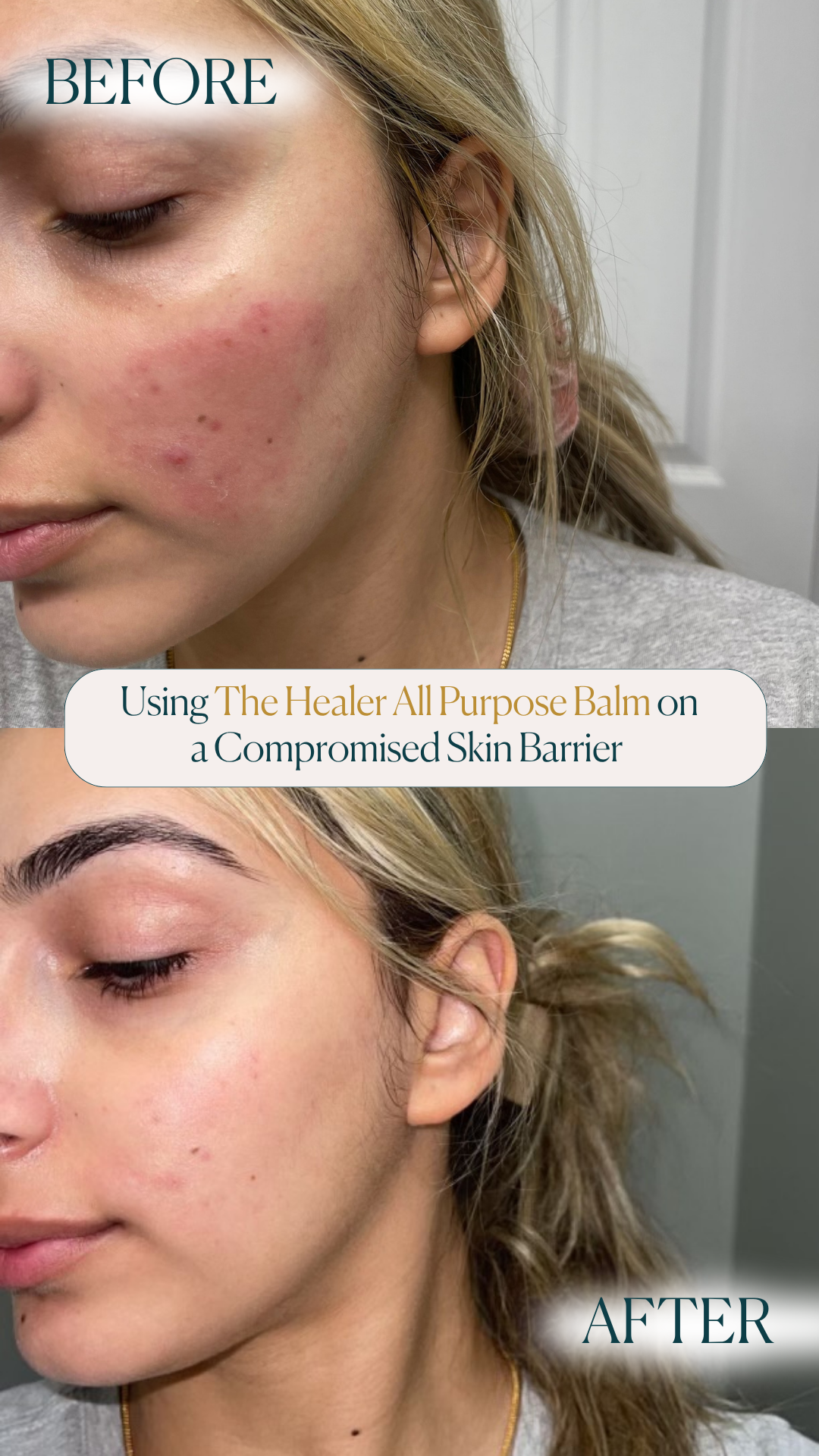 The Healer All Purpose Balm