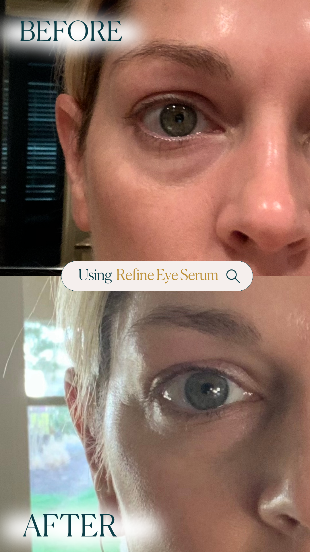 Refine Eye Serum