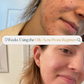 Oily / Acne Prone Skin Advanced Regimen