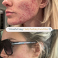 Clarify Purifying Facial Mist