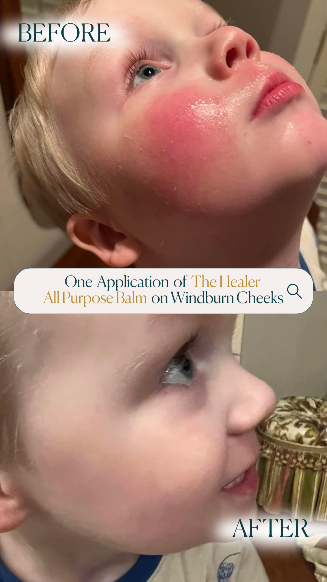 The Healer All Purpose Balm