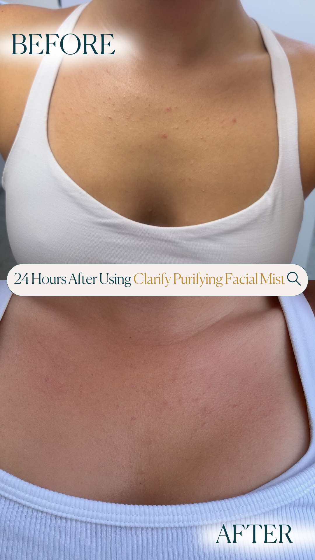 Clarify Purifying Facial Mist