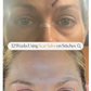 Emogene Signature Scar Salve