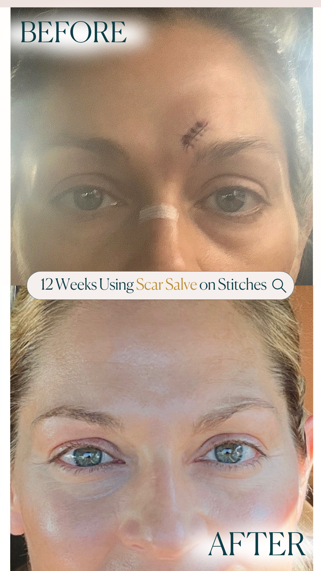 Emogene Signature Scar Salve
