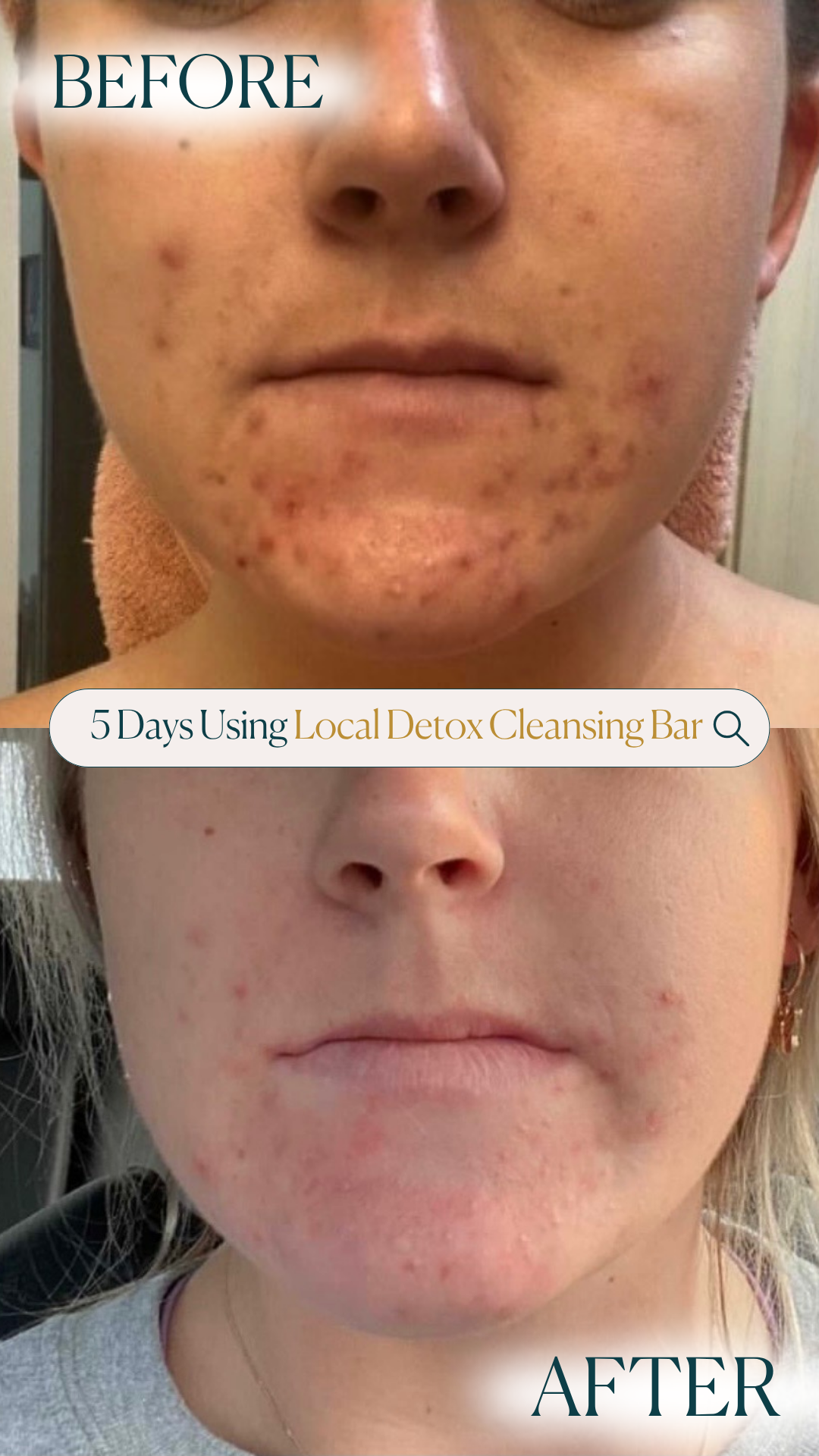 Local Detox Cleansing Bar