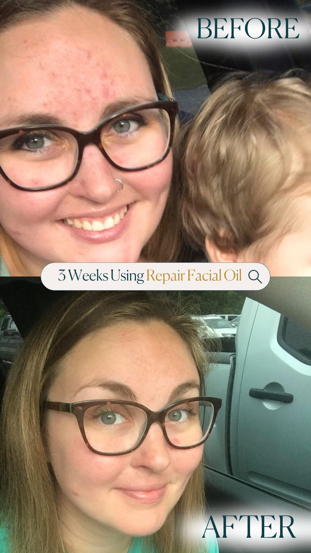 Facial Oil Duo