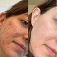 Oily / Acne Prone Skin Basic Regimen