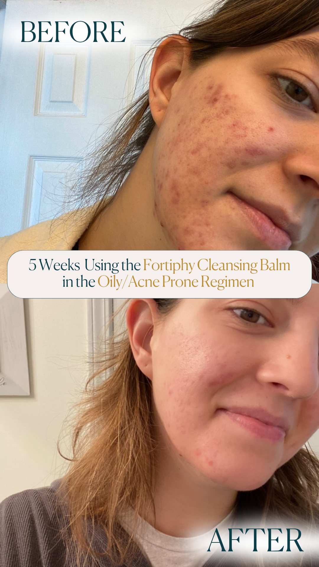 Fortiphy Facial Cleansing Balm
