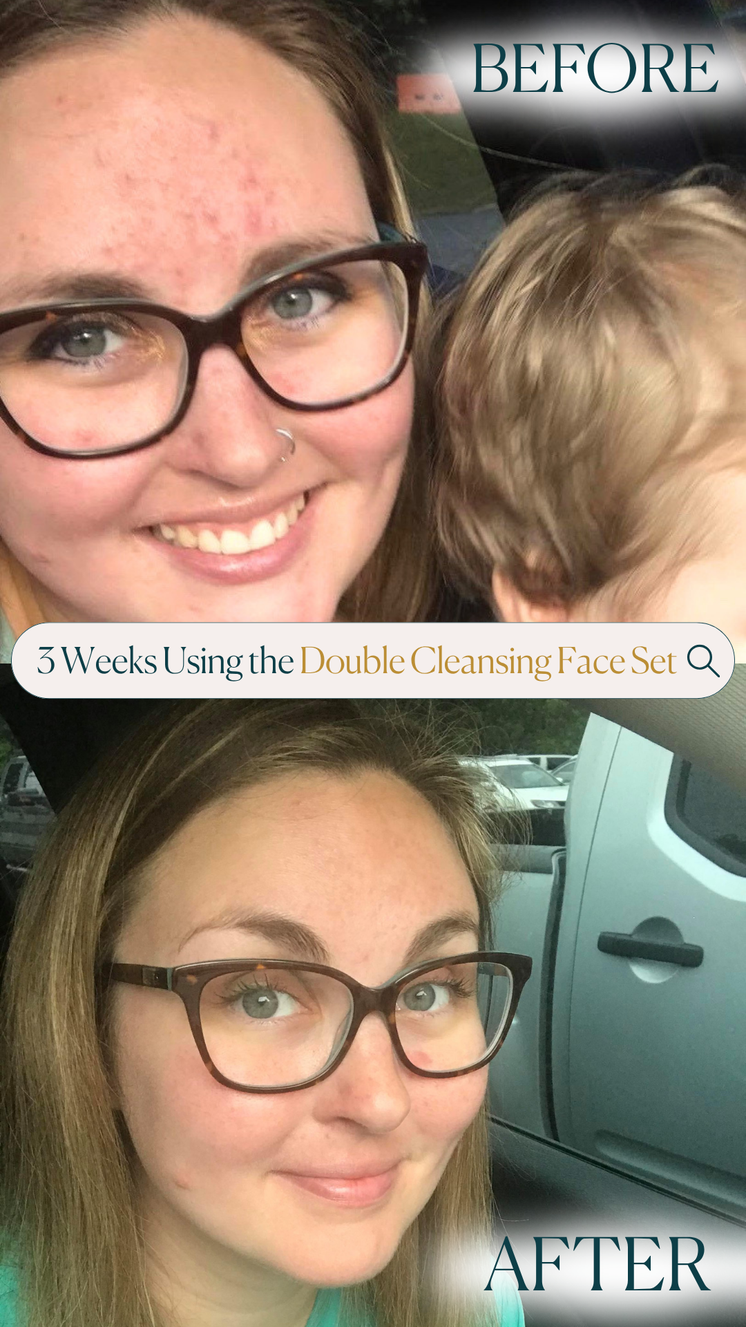 Double Cleansing Face Set