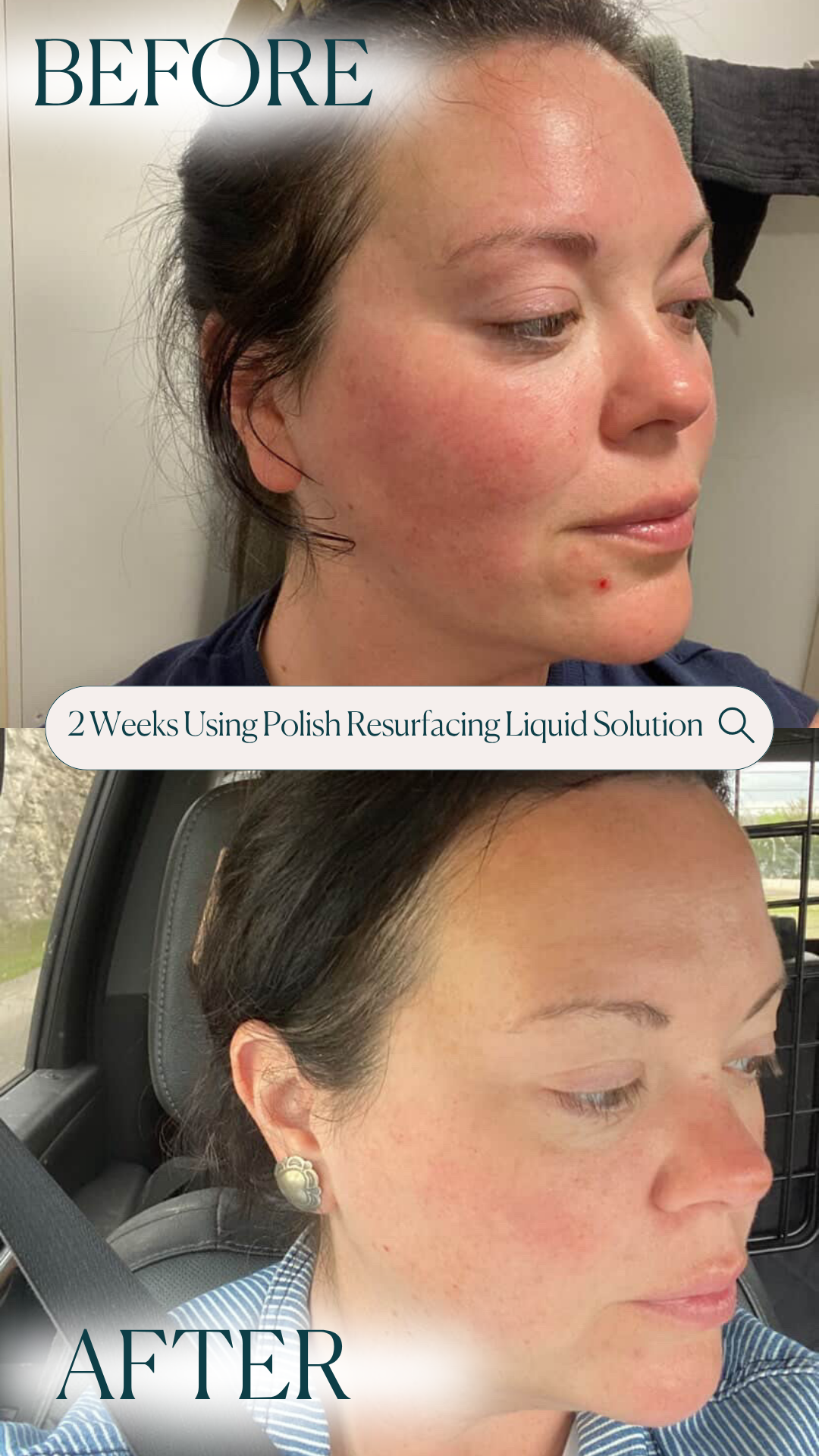 Polish Resurfacing Liquid Solution