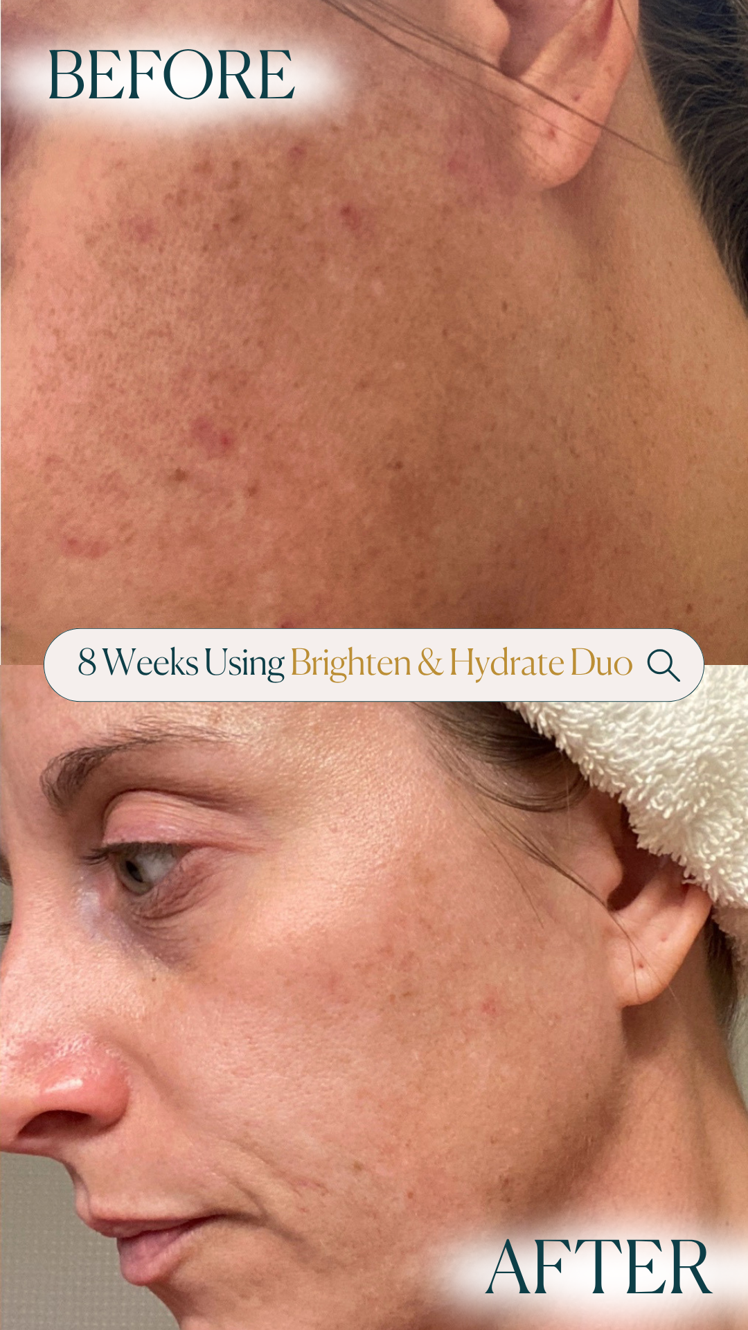 Brighten and Hydrate Duo