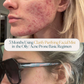 Clarify Purifying Facial Mist