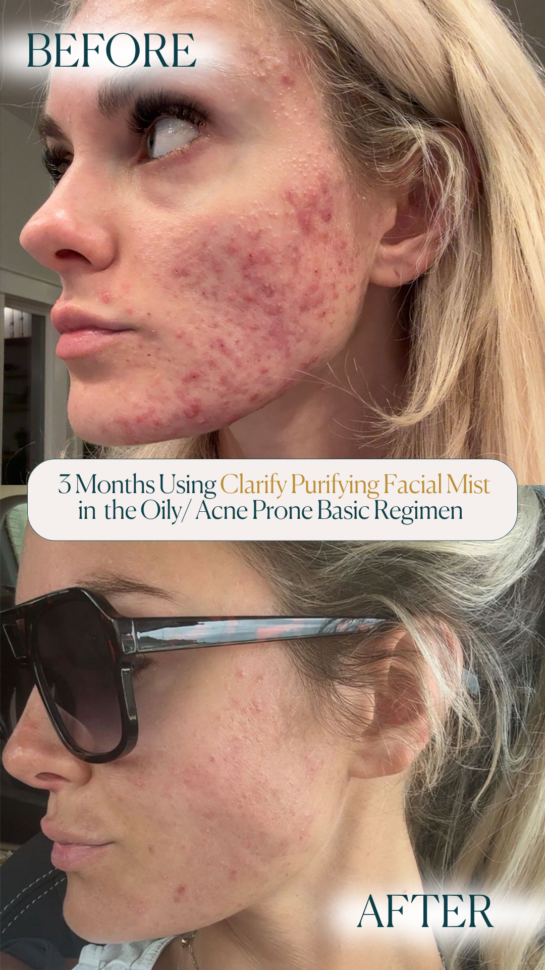 Clarify Purifying Facial Mist
