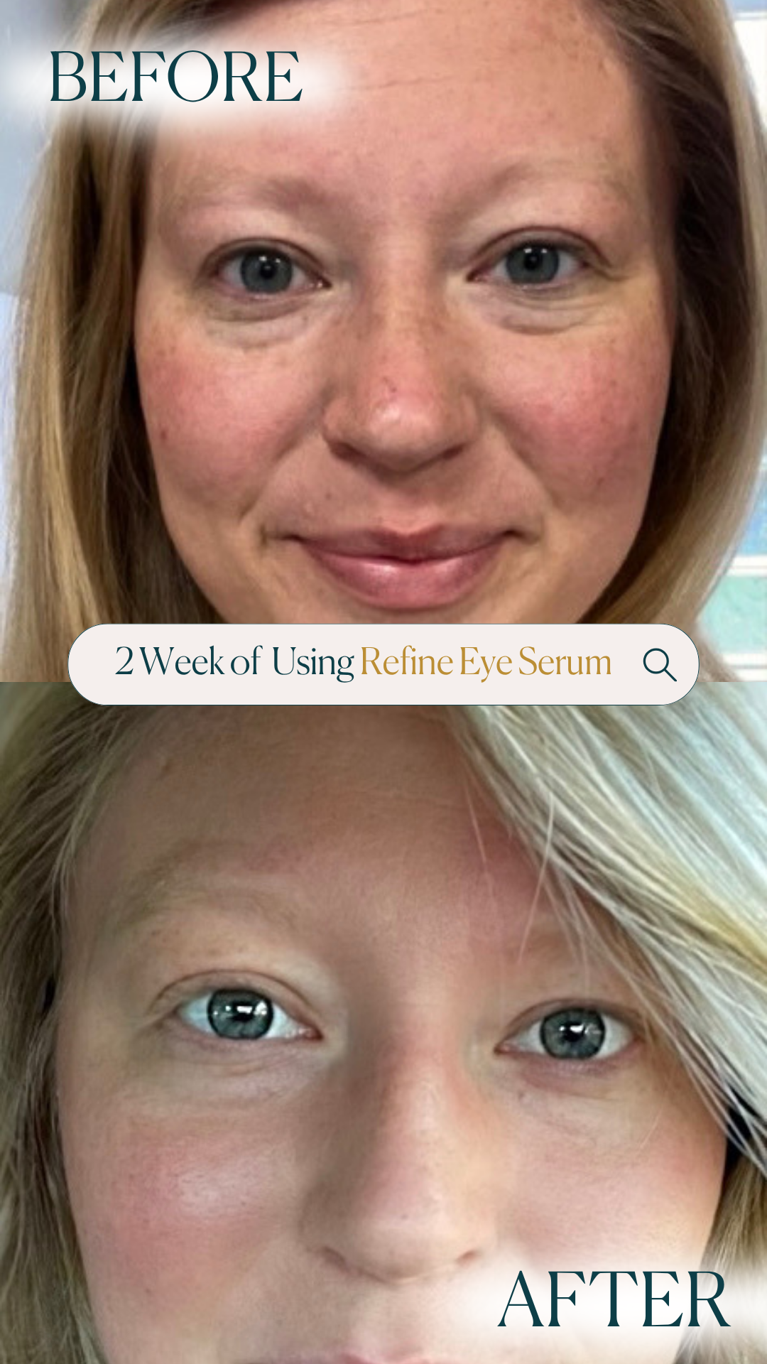 Refine Eye Serum