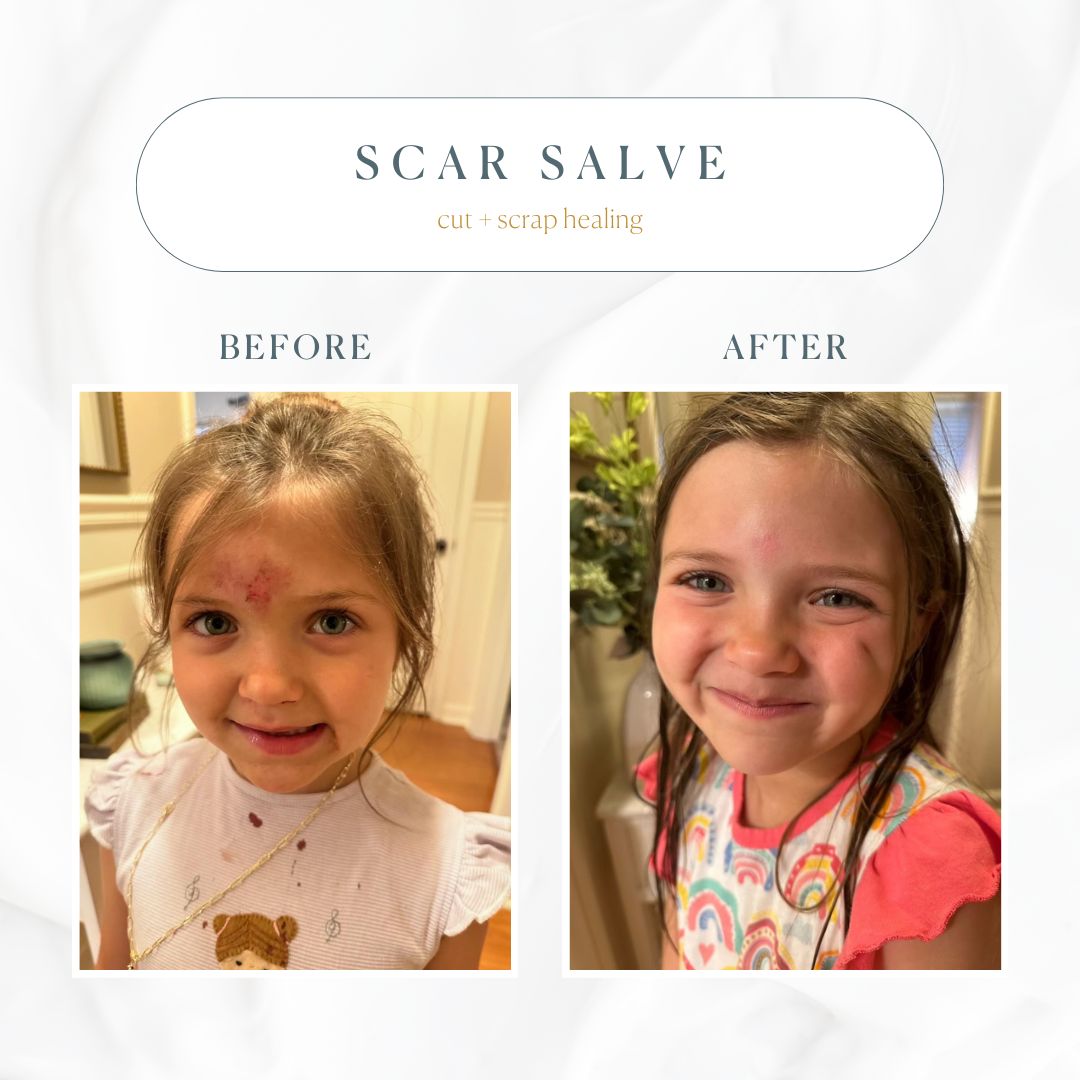 Emogene Signature Scar Salve