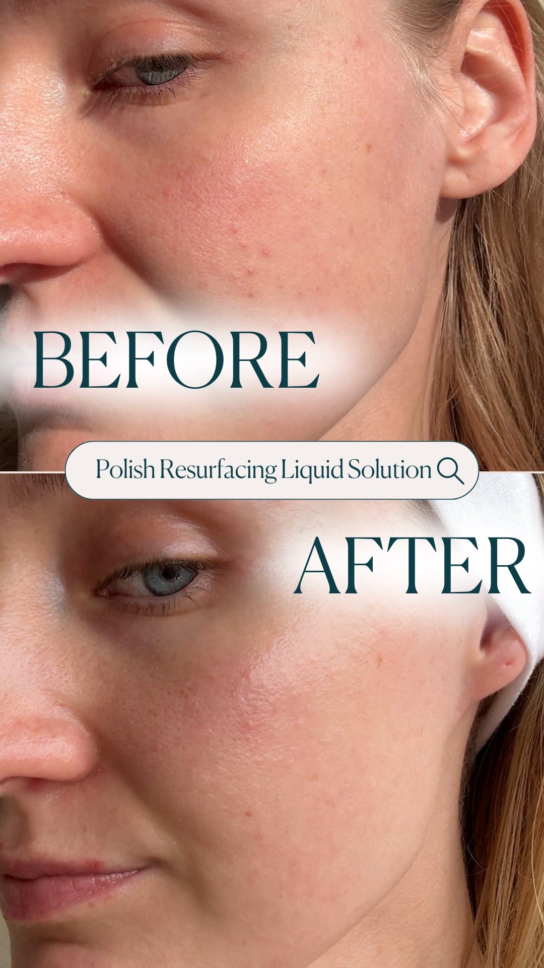 Polish Resurfacing Liquid Solution