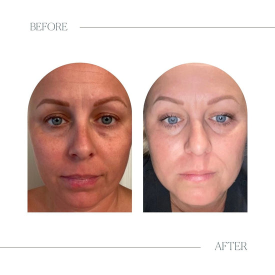 Glow Vitamin C Serum Emogene & Co