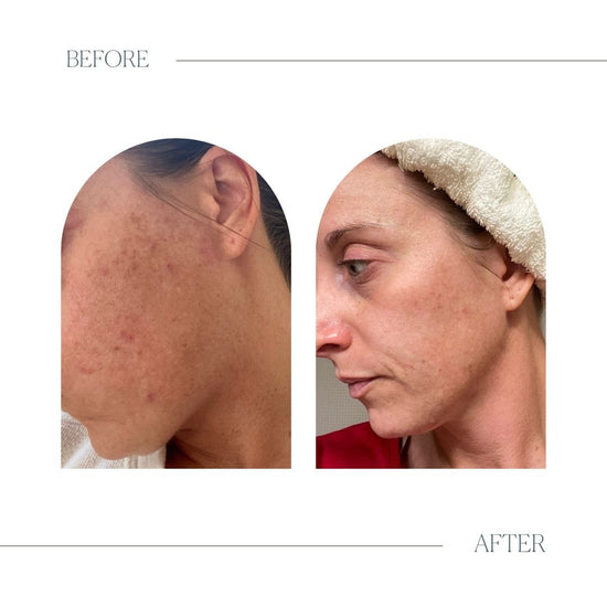 Glow Vitamin C Serum Emogene & Co