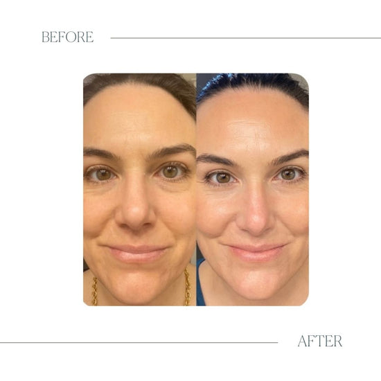 Glow Vitamin C Serum Emogene & Co